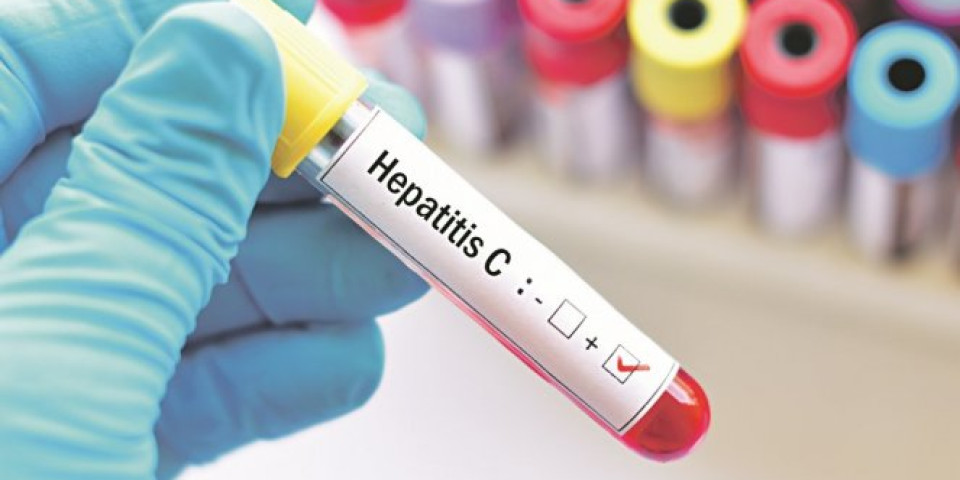 DA LI NAM PRETI NOVA PANDEMIJA? Hepatitis misterioznog porekla otkriven MEĐU DECOM u Evropi i SAD!