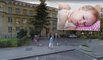 Zarazili se majka i sin (4)! Dete nevakcinisano: Novi slučaj malih boginja u Beogradu