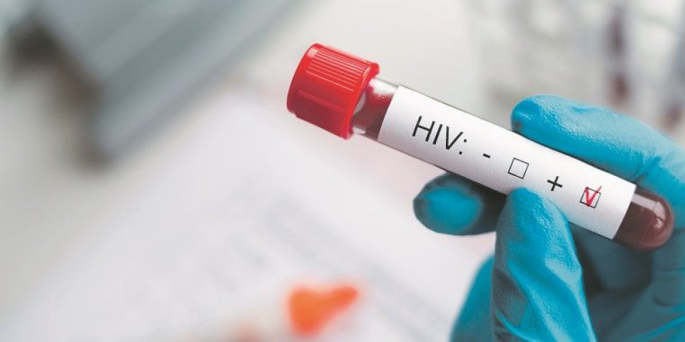 Evropska nedelja testiranja na HIV: Najmlađi pacijent ima 16 godina! Važna je prevencija i edukacija!