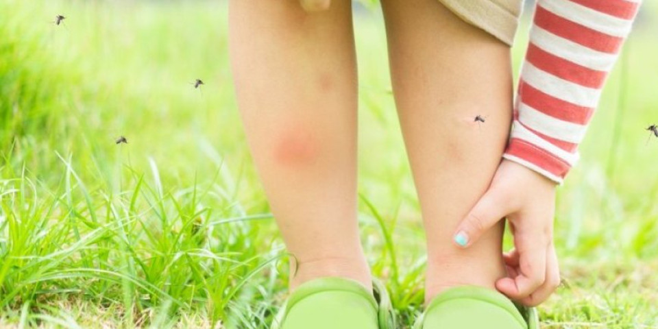 Čime da ublažite reakciju na ujed komaraca kod dece? Pomažu kap meda, list bosiljka...