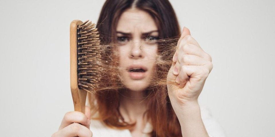 Postkovid i kako ga lečiti: Sve više ljudi se žali na prekomerno opadanje kose!