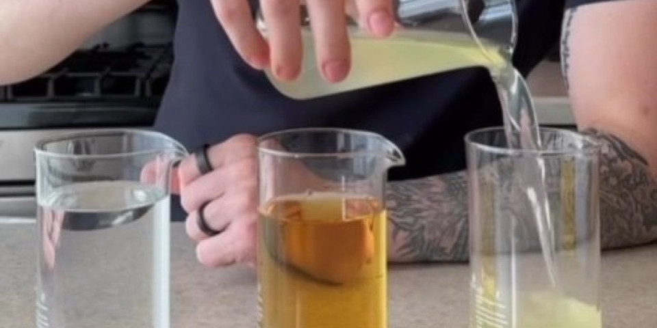Obratite pažnju! Doktor otkriva šta boja urina govori o vašem zdravlju (VIDEO)
