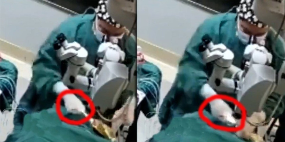 Jezivo! Hirurg tokom operacije nabada pacijentkinju, isplivao snimak iz sale (VIDEO)
