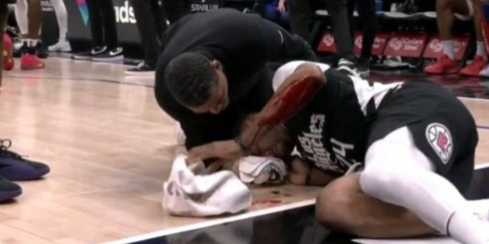 Horor u NBA ligi! Košarkašu šikljala krv iz glave! (VIDEO)