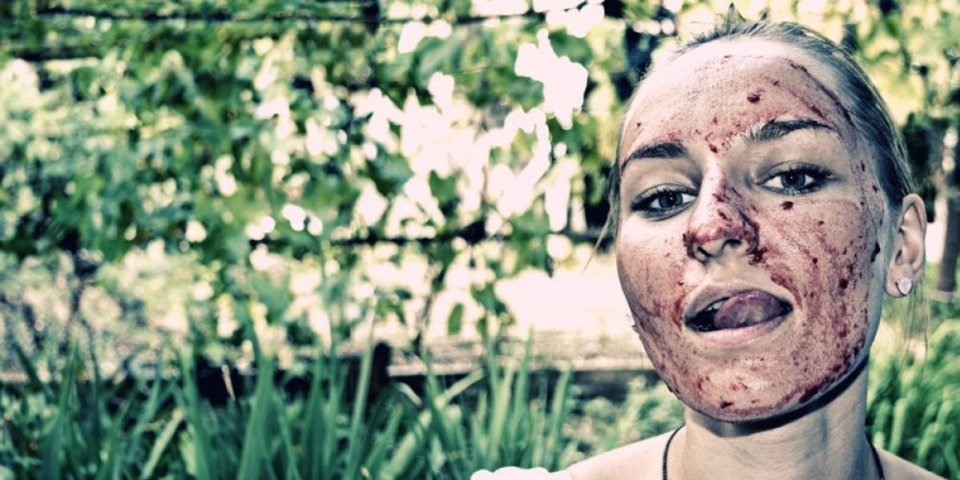 Ljudi zgroženi! Devojka tvrdi da je menstrualna krv zaslužna za njenu lepotu! "Nemam bore, a očistila sam lice od akni" (FOTO/VIDEO)