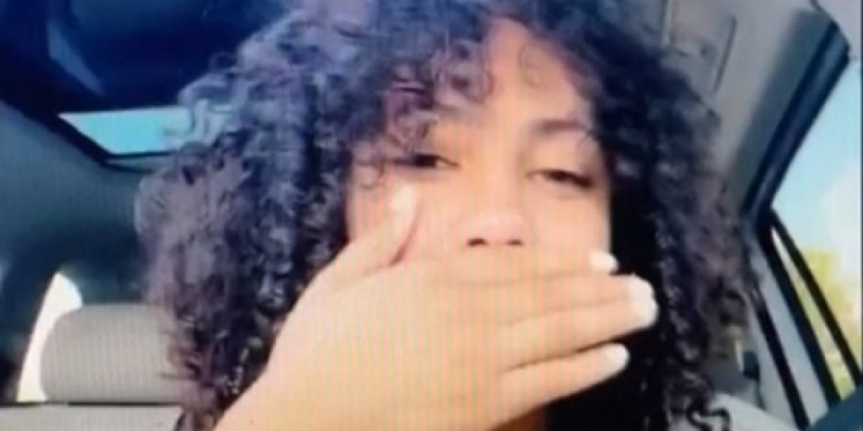 UŽASAN SNIMAK POLICIJSKOG NASILJA! Prelepu studentkinju gumeni metak pogodio u lice, pogledajte JEZIVE POSLEDICE (VIDEO)