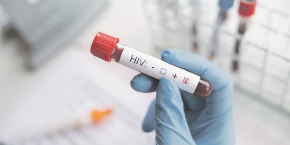 ZARAŽENI HIV-om NE ŠIRE VIRUS AKO URADE SAMO JEDNU STVAR!