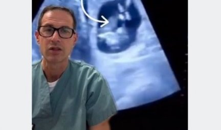 Lekar objavio ultrazvuk stomaka jedne žene i tvrdi: Mislio sam da sam video sve, ALI OVO JE PRAVI ŠOK